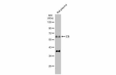 Western Blot: Complement Component C9 Antibody [NBP2-15952]