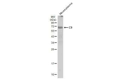 Western Blot: Complement Component C9 Antibody [NBP2-15952]