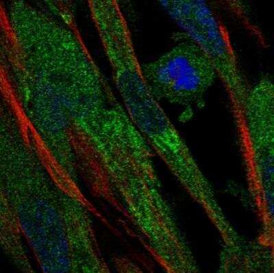 Immunocytochemistry/ Immunofluorescence: Complement Factor B Antibody [NBP1-89985]