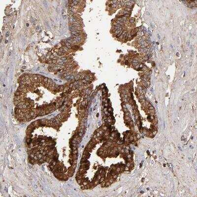 Immunohistochemistry: Complement Factor B Antibody [NBP1-89986]