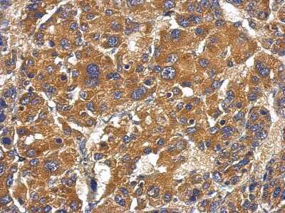 Immunohistochemistry-Paraffin: Complement Factor B Antibody [NBP2-15953]