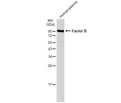 Western Blot: Complement Factor B Antibody [NBP2-15953]