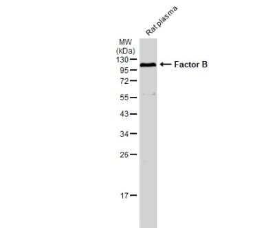 Western Blot: Complement Factor B Antibody [NBP2-15953]