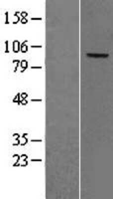 Western Blot: Complement Factor B Overexpression Lysate [NBL1-09119]