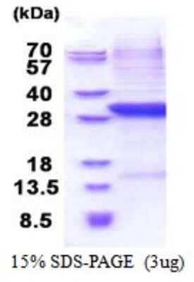 SDS-PAGE: Recombinant Human Complement Factor B His Protein [NBP2-51557]