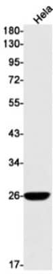 Western Blot: Complement Factor D/Adipsin Antibody (S09-6A9) [NBP3-19629]