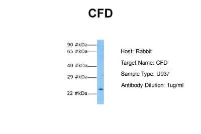 Western Blot: Complement Factor D/Adipsin Antibody [NBP1-79793]