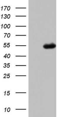 Western Blot: Complement Factor H Antibody (OTI5H5) [NBP2-46263]