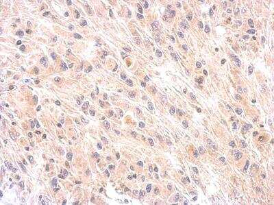 Immunohistochemistry-Paraffin: Complement Factor H Antibody [NBP1-33628]