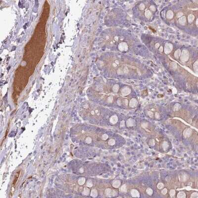Immunohistochemistry-Paraffin: Complement Factor H Antibody [NBP2-33933]