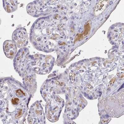 Immunohistochemistry-Paraffin: Complement Factor H Antibody [NBP2-38695]