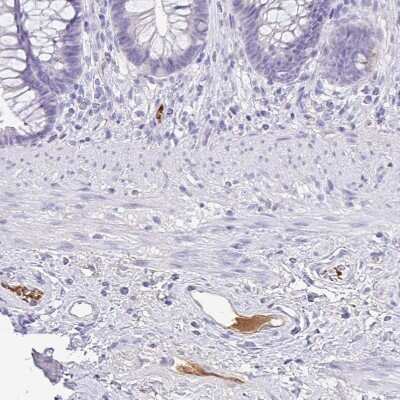 Immunohistochemistry-Paraffin: Complement Factor H Antibody [NBP2-38695]