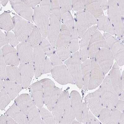 Immunohistochemistry-Paraffin: Complement Factor H Antibody [NBP2-38695]