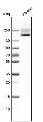 Western Blot: Complement Factor H Antibody [NBP2-33933]