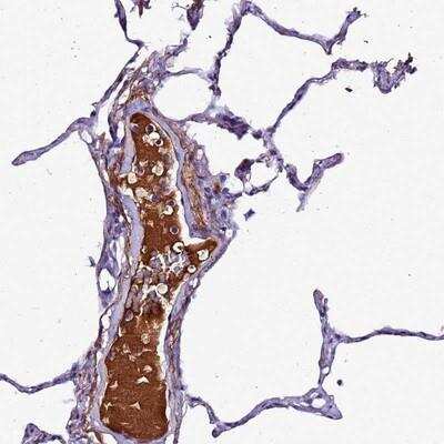 Immunohistochemistry: Complement Factor H-related 1/CFHR1/CFHL1 Antibody [NBP2-14475]