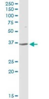 Western Blot: Complement Factor H-related 1/CFHR1/CFHL1 Antibody [H00003078-D01P]