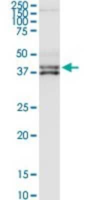 Western Blot: Complement Factor H-related 1/CFHR1/CFHL1 Antibody [H00003078-D01P]