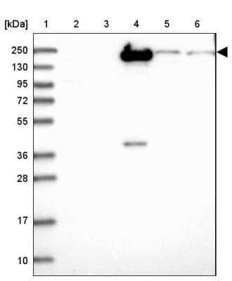 Western Blot: Complement Factor H-related 1/CFHR1/CFHL1 Antibody [NBP2-14474]