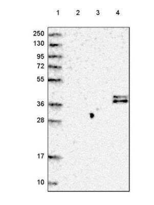 Western Blot: Complement Factor H-related 1/CFHR1/CFHL1 Antibody [NBP2-54683]