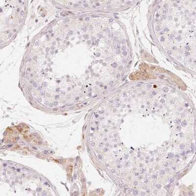 Immunohistochemistry: Complement Factor H-related 2/CFHR2/CFHL2 Antibody [NBP2-48947]