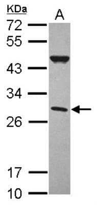 Western Blot: Complement Factor H-related 2/CFHR2/CFHL2 Antibody [NBP2-14911]