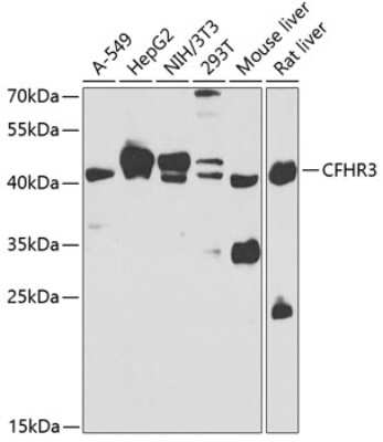 Western Blot: Complement Factor H-related 3/CFHR3 AntibodyBSA Free [NBP2-92515]