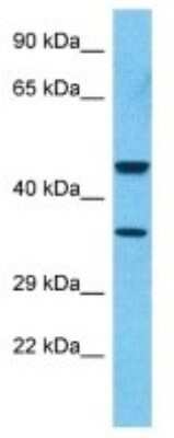 Western Blot: Complement Factor H-related 3/CFHR3 Antibody [NBP3-10616]