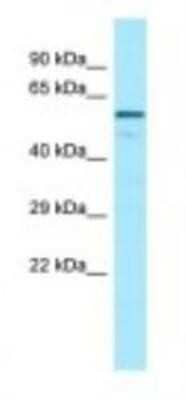 Western Blot: Complement Factor H-related 4/CFHR4 Antibody [NBP1-98532]