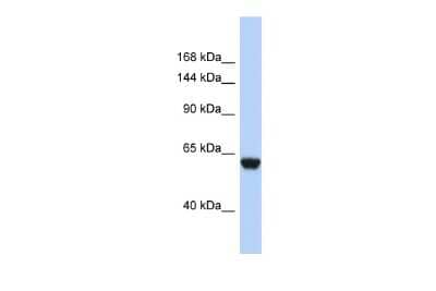 Western Blot: Complement Factor H-related 4/CFHR4 Antibody [NBP3-10545]