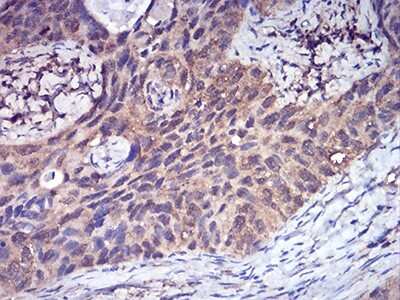 Immunohistochemistry: Complement Factor H-related 5/CFHR5 Antibody (3A10A5) - BSA Free [NBP2-52441]