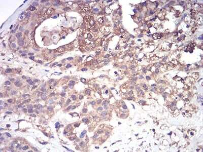 Immunohistochemistry: Complement Factor H-related 5/CFHR5 Antibody (3A10A5) - BSA Free [NBP2-52441]
