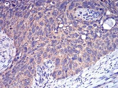 Immunohistochemistry: Complement Factor H-related 5/CFHR5 Antibody (3E1E10) - BSA Free [NBP2-52440]
