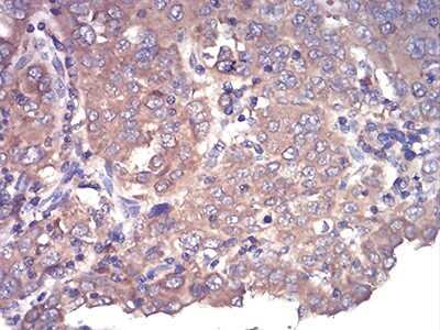 Immunohistochemistry: Complement Factor H-related 5/CFHR5 Antibody (3E1E10) - BSA Free [NBP2-52440]