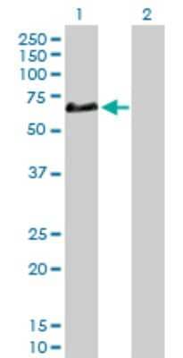 Western Blot: Complement Factor H-related 5/CFHR5 Antibody [H00081494-D01P]