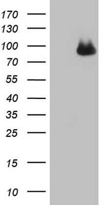 Western Blot: Complement Factor I Antibody (OTI7C9) [NBP2-46264]