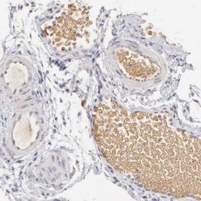 Immunohistochemistry-Paraffin: Complement Factor I Antibody [NBP1-88268]