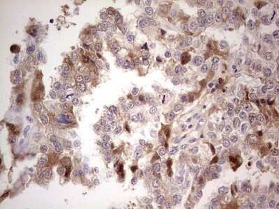Immunohistochemistry: Complement Factor I Antibody (OTI7C9) - Azide and BSA Free [NBP2-70997]