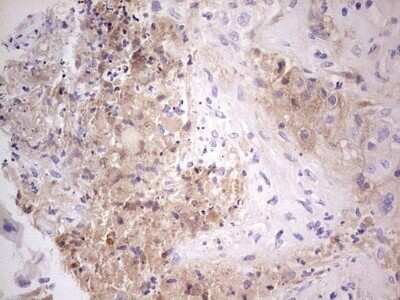 Immunohistochemistry: Complement Factor I Antibody (OTI7C9) - Azide and BSA Free [NBP2-70997]