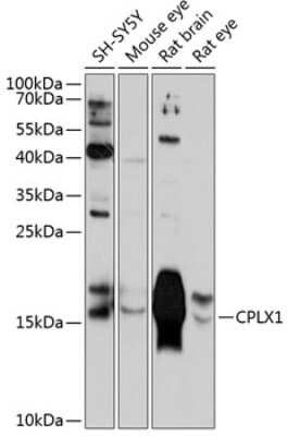 Western Blot: Complexin-1 AntibodyAzide and BSA Free [NBP3-03264]