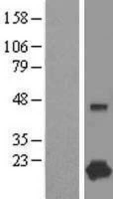 Western Blot: Complexin-1 Overexpression Lysate [NBL1-09435]