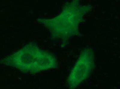 Immunocytochemistry/ Immunofluorescence: Complexin-2 Antibody (021) [NBP2-90019]