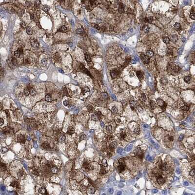 Immunohistochemistry-Paraffin: Complexin-2 Antibody [NBP3-17821]