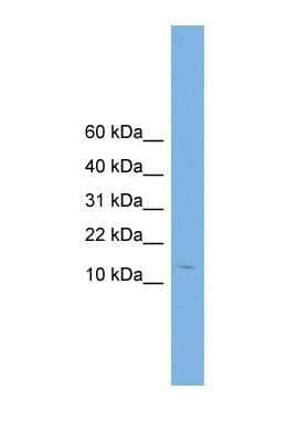 Western Blot: Complexin-2 Antibody [NBP1-57001]