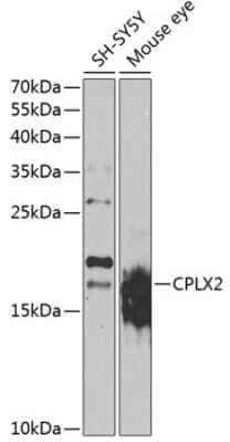 Western Blot: Complexin-2 AntibodyBSA Free [NBP2-92514]