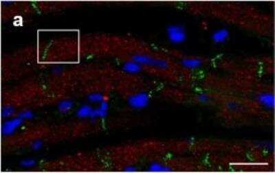 Immunocytochemistry/ Immunofluorescence: Connexin 26/GJB2 Antibody - BSA Free [NBP2-41304]