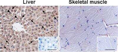 Immunohistochemistry: Connexin 26/GJB2 Antibody - BSA Free [NBP2-41304]