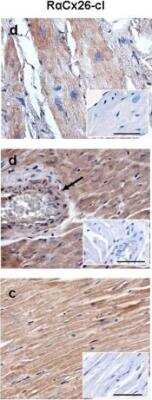 Immunohistochemistry: Connexin 26/GJB2 Antibody - BSA Free [NBP2-41304]