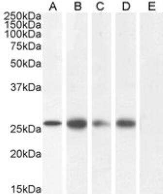 Western Blot: Connexin 26/GJB2 Antibody [NB100-57840]
