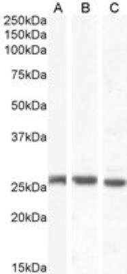 Western Blot: Connexin 26/GJB2 Antibody [NB100-57840]