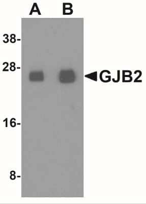 Western Blot: Connexin 26/GJB2 AntibodyBSA Free [NBP2-41304]